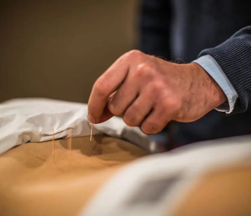Acupuncture improves blood flow