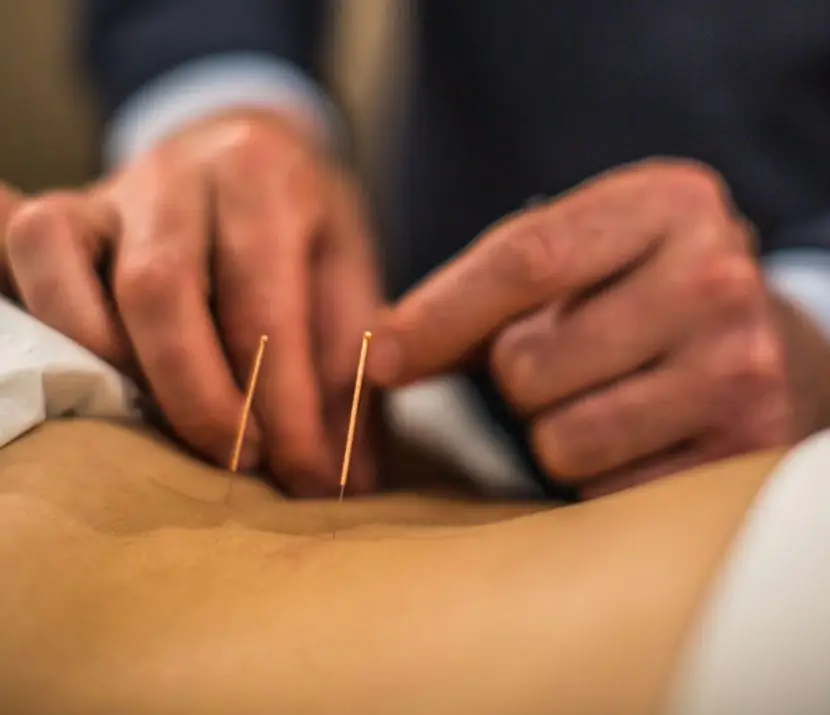 Acupuncture relieves pain & inflammation